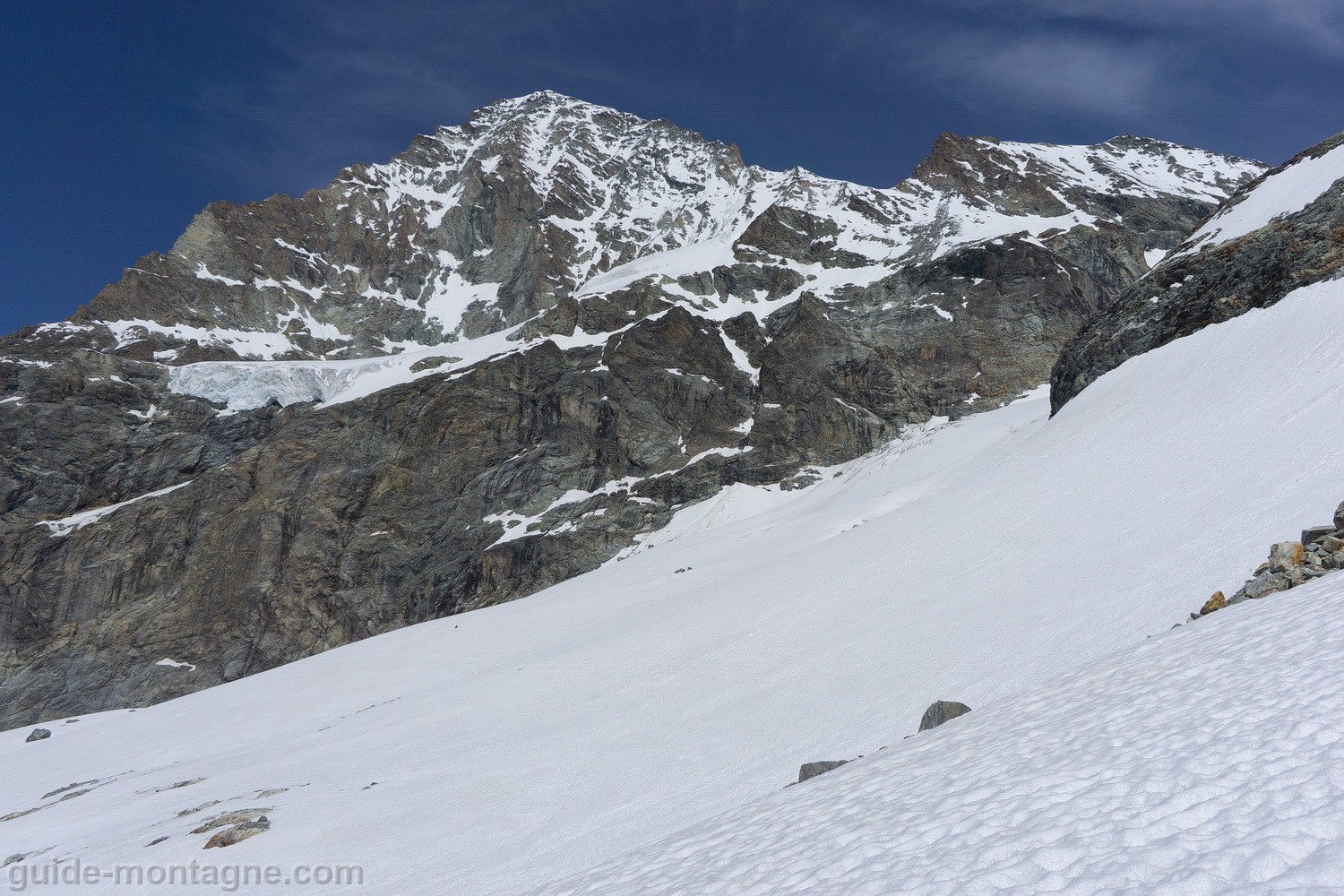 dentblanche2025_18